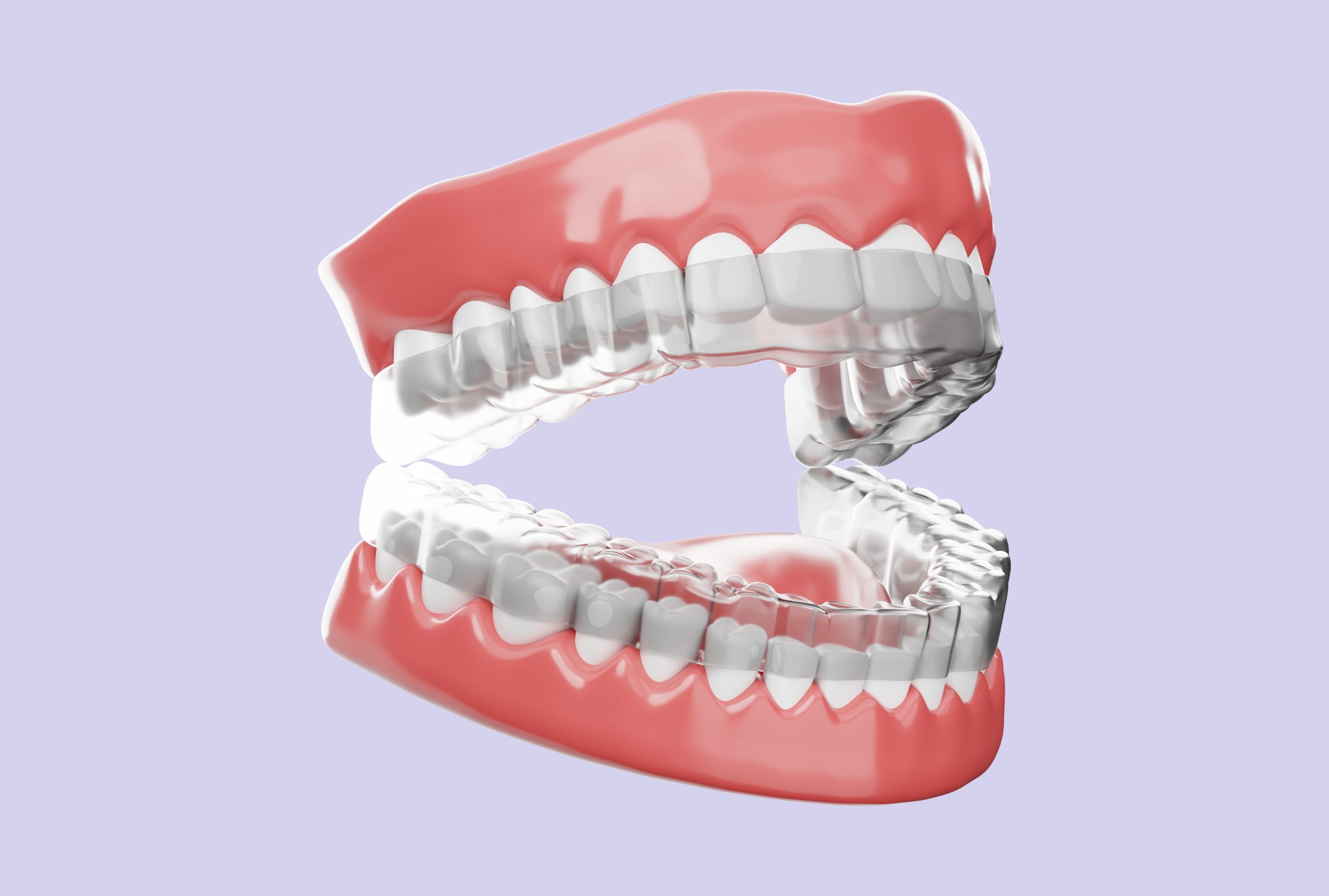 マウスピース型矯正装置のイメージ