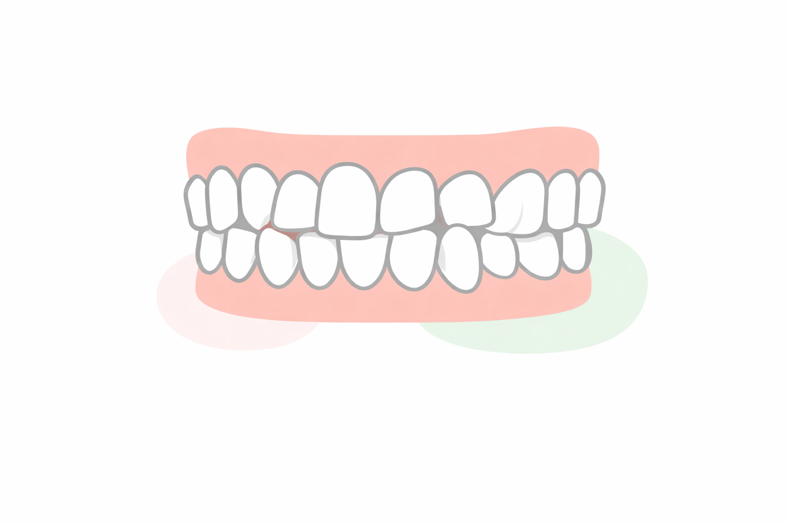 叢生（そうせい）のイラスト